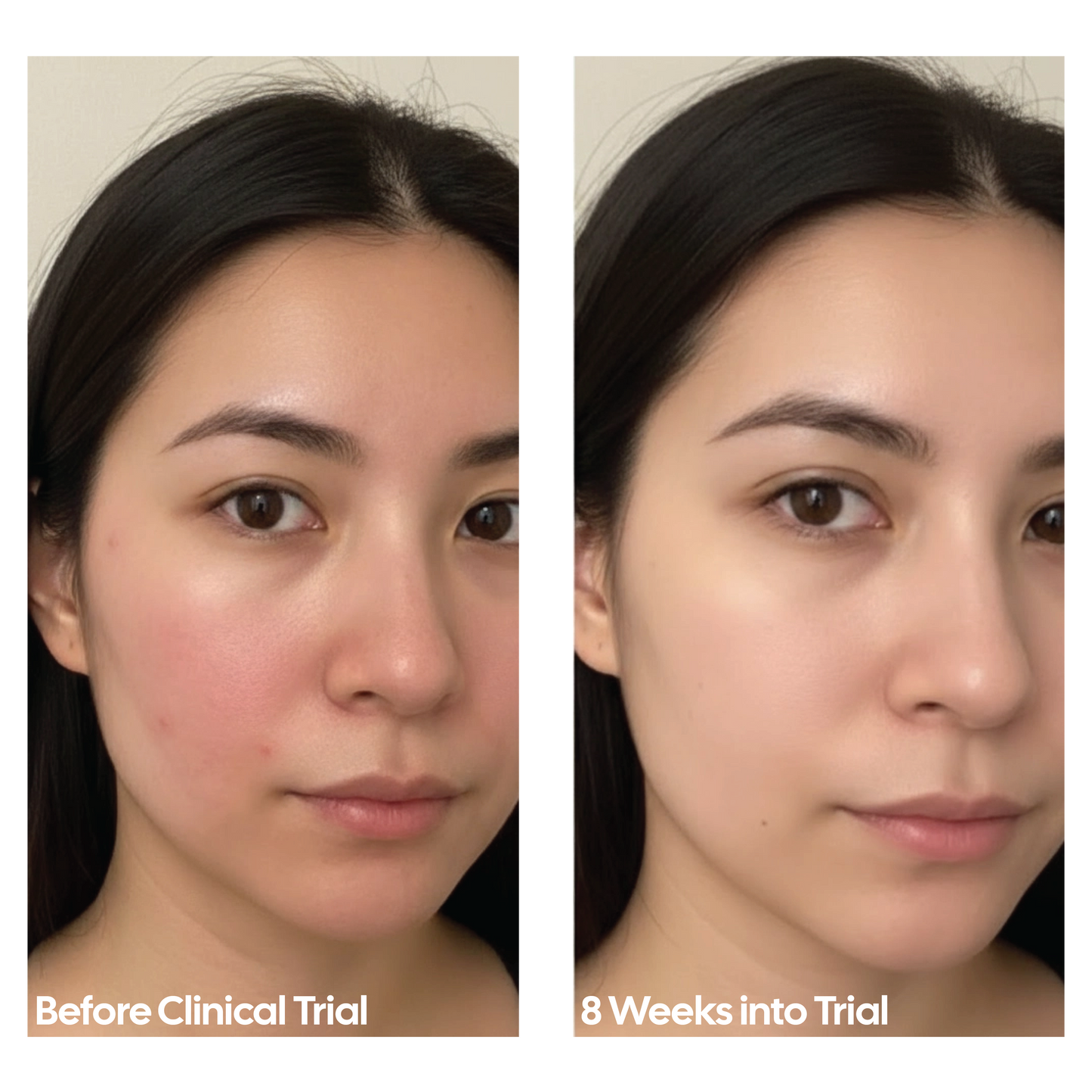 REDO Red Light Therapy Mask